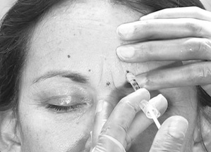 Botox Behandeling